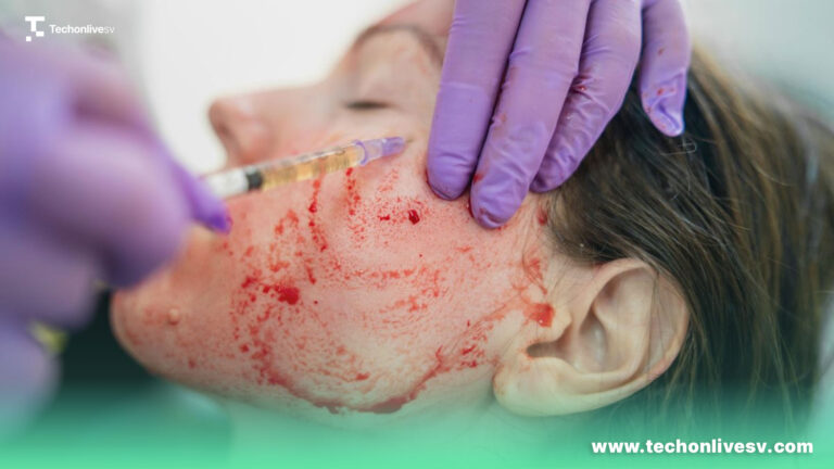 Vampire-facial