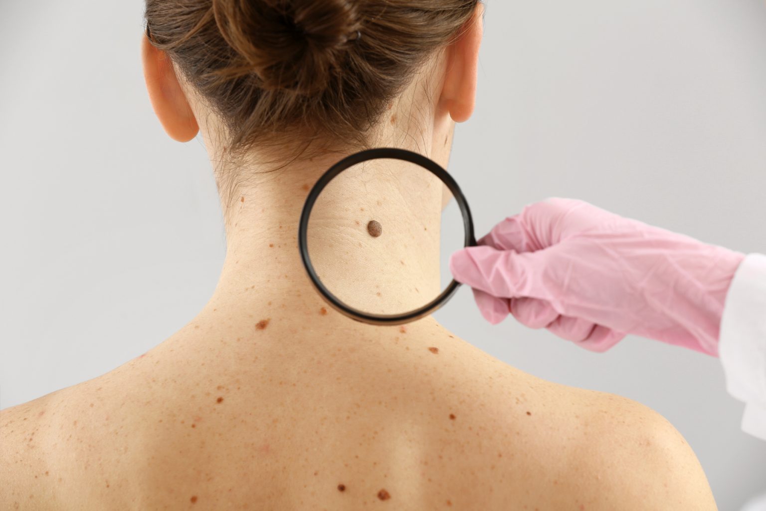 banner-recomendacion-claves-para-prevenir-cancer-a-la-piel